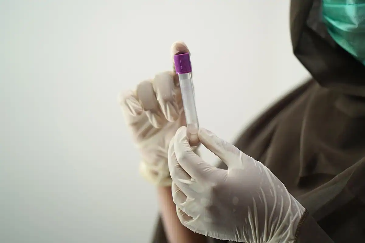 Mâini cu mănuși care țin o eprubetă cu dop mov pentru dozarea hormonilor tiroidieni