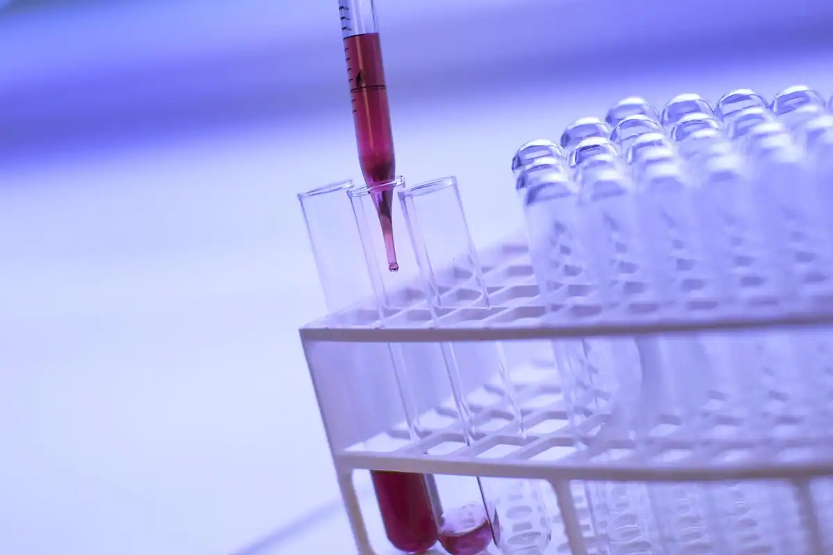 Pipetă și eprubete într-un laborator de analize, pregătite pentru o determinare hormonală