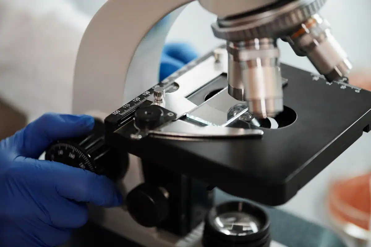 Mână cu mănușă albastră care reglează un microscop pentru numărarea leucocitelor