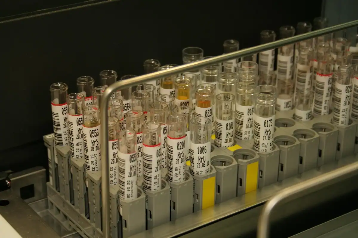 Rând lung de eprubete etichetate într-un analizor automat pentru probe de urină
