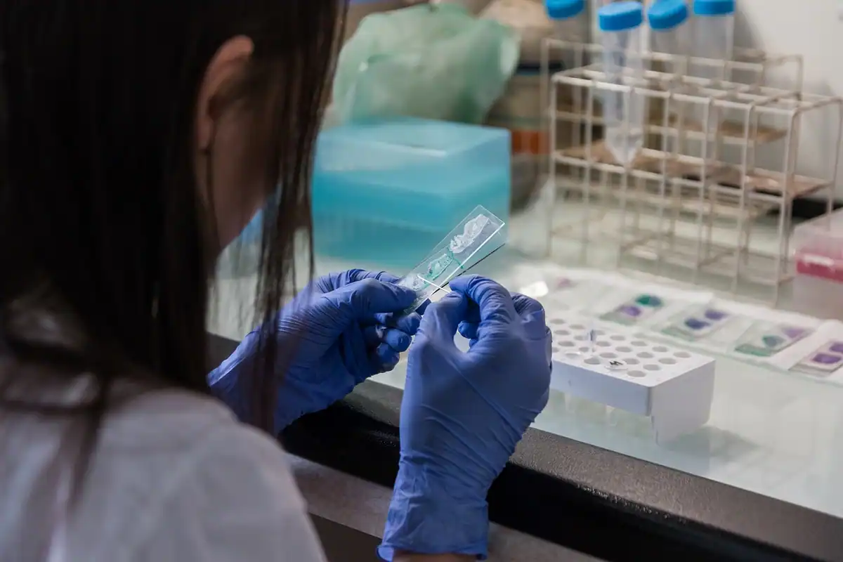 Tânără laborantă care manipulează cu mănuși o bandă de testare pentru examenul urinei