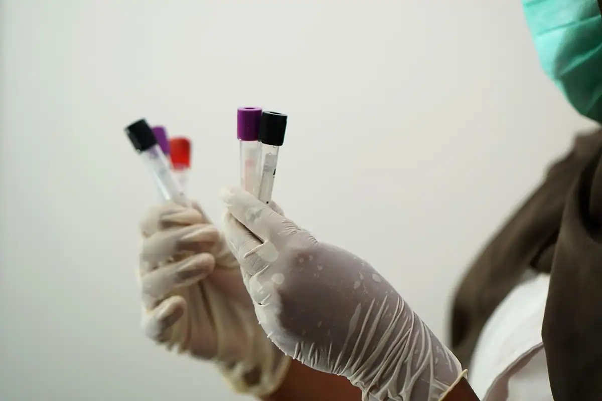 Mâini cu mănuși care țin eprubete de sânge pentru testele de coagulare