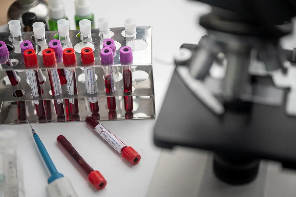 Suport cu eprubete de sânge colorate lângă un microscop, pe masa de laborator