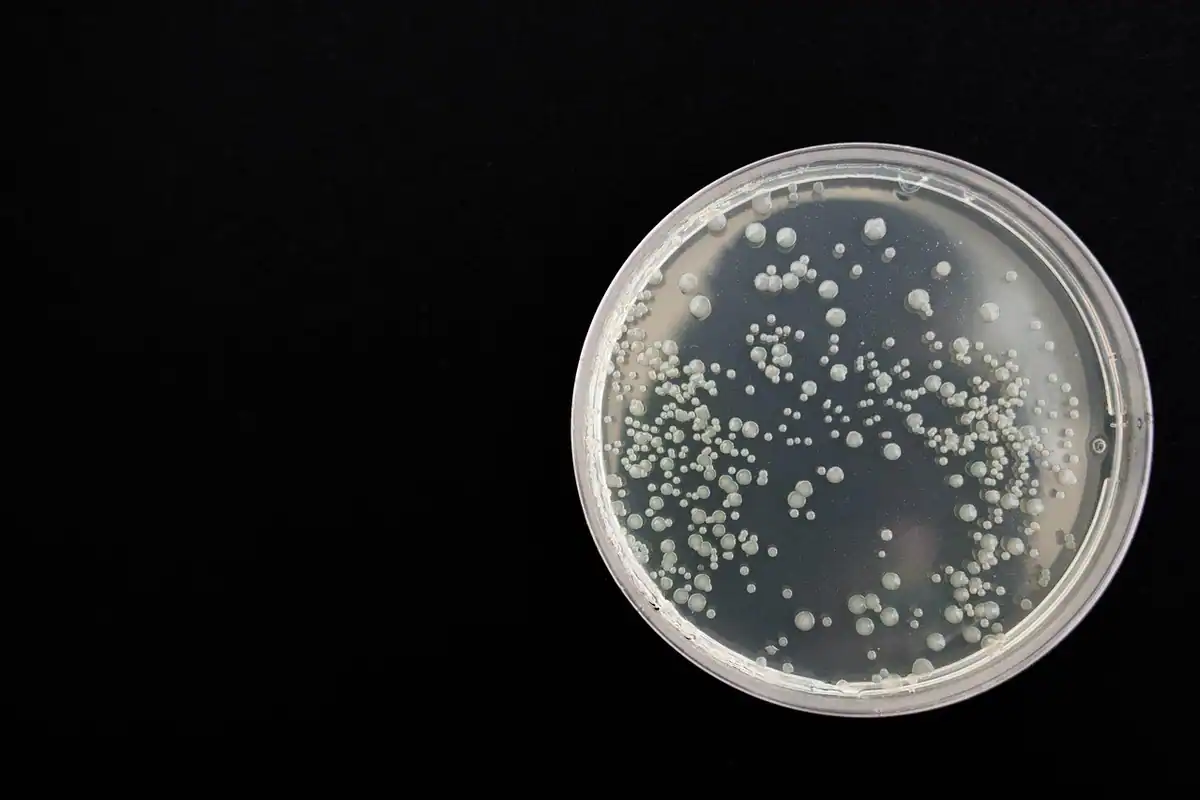 Placă Petri cu colonii de bacterii crescute pe mediu de cultură, pe fundal negru